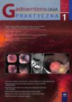 Gastroenterologia praktyczna nr.1-2017