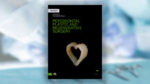 periodontal1